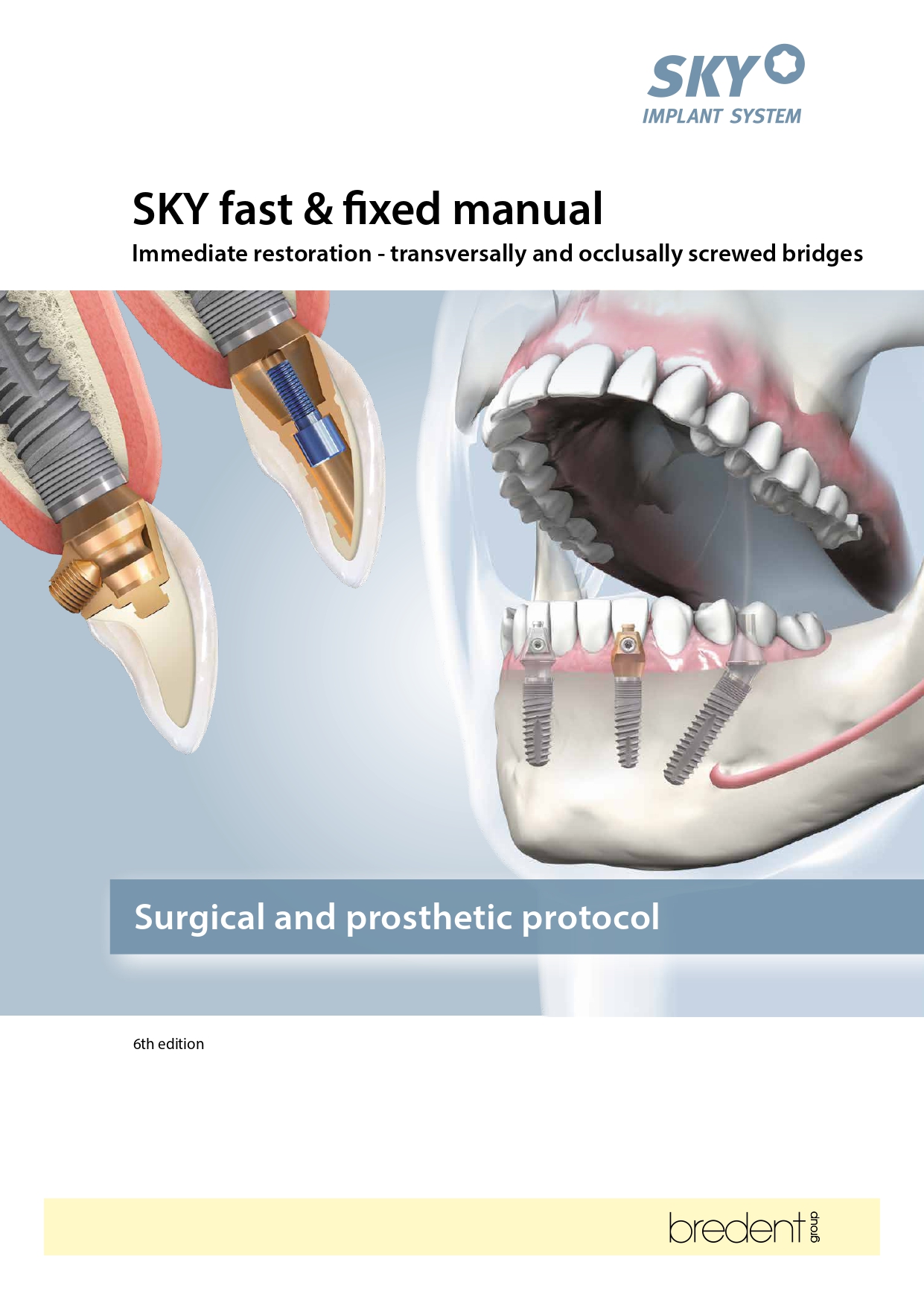 SKY fast & fixed manual – Brochure cover
